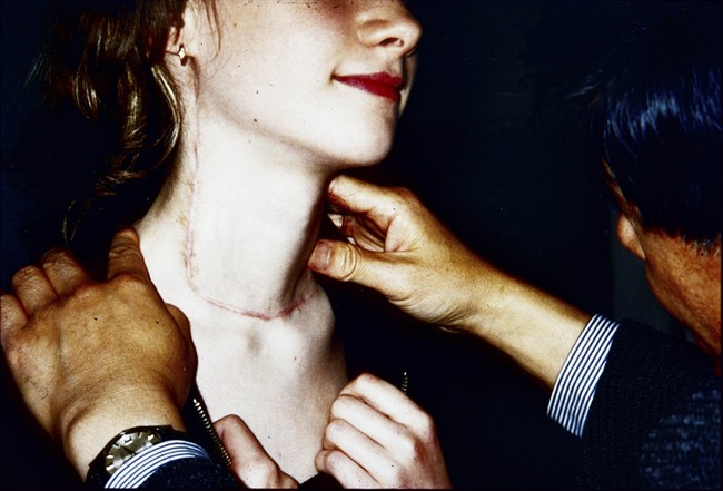 Dr. Akira Sugenoya checks the throat of a patient who went through a surgery to treat Chernobyl thyroid cancer at the Balarus Thyroid Cancer Center in Minsk, Belarus. 