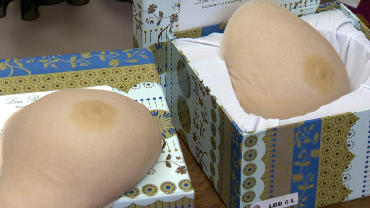 A group of women are petitioning the government to make prosthetic breasts covered under the Saskatchewan health benefits program.