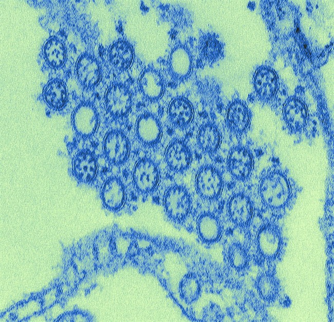 An digitally colored image of the H1N1 flu virus is shown in a handout photo. A new study suggests the number of people who died from H1N1 pandemic flu in 2009 was similar to the annual toll taken by seasonal flu.THE CANADIAN PRESS/HO- Centers for Disease Control/Cynthia Goldsmith.
