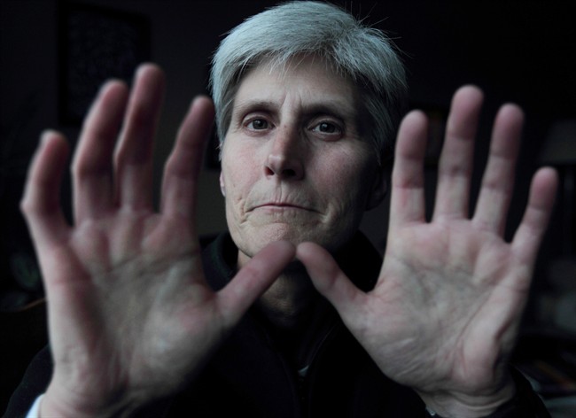 Michelle Richard holds up her hands at her home in Halifax on Thursday, Nov. 14, 2013.