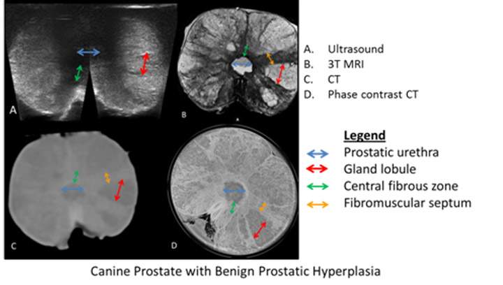 Phase contrast CT image from research at the University of Saskatchewan looking at developing new ways to diagnose prostate cancer.