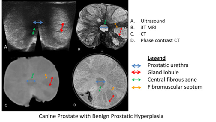 Researchers developing new ways to diagnose prostate