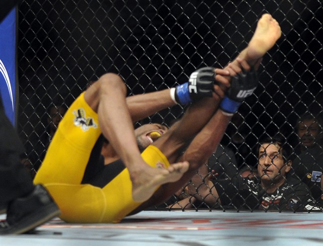 Anderson Silva, of Brazil screams, after kicking Chris Weidman ,of Baldwin, N.Y., and injuring his leg during the UFC 168 mixed martial arts middleweight championship bout on Saturday, Dec. 28, 2013, in Las Vegas. 