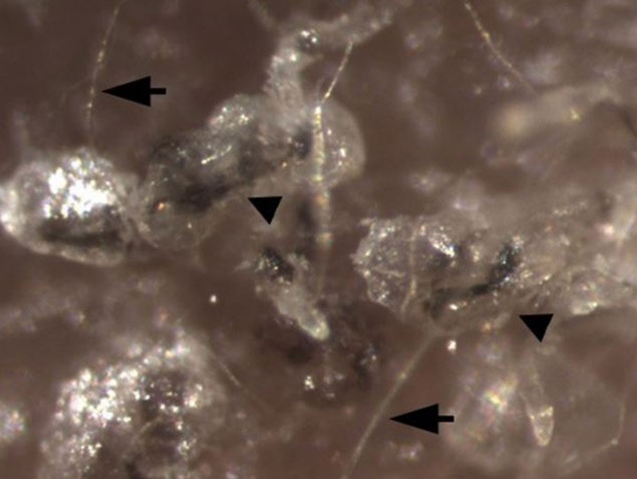 Hair shafts (arrows) formed by induced stem cell-derived epithelial stem cells. (Supplied photo)