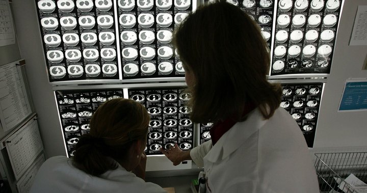 Nearly 1 in 2 Canadians expected to get cancer. Here's why