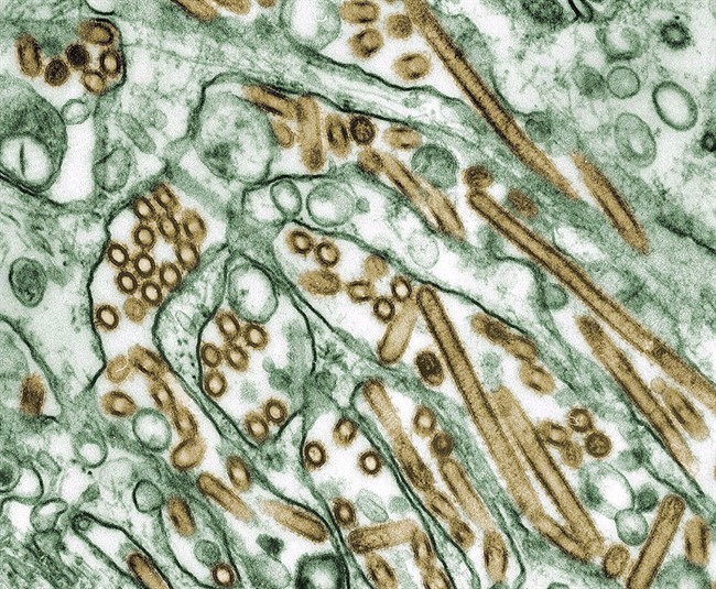 A colourized transmission electron micrograph of Avian influenza A H5N1 viruses (seen in gold) grown in MDCK cells (seen in green) are shown in this 1997 image.