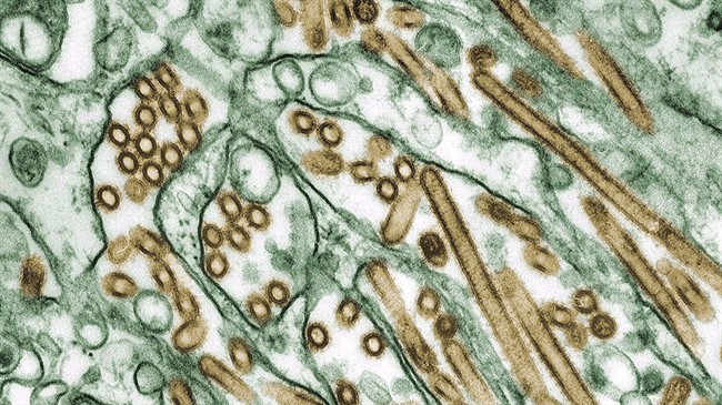 A colourized transmission electron micrograph of Avian influenza A H5N1 viruses (seen in gold) are shown in this 1997 image. Canada expands poultry restrictions as avian flu spreads to more U.S. states.
