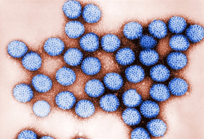 This transmission electron micrograph shows intact rotavirus particles. 