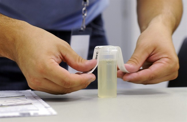 A urine specimen vial is labelled at Linn State Technical College in Linn, Mo., Wednesday, Sept. 7, 2011. Urine can tell a lot about a person's health, especially when it comes to colour.