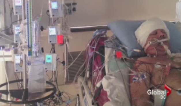 Longboard attack victim.