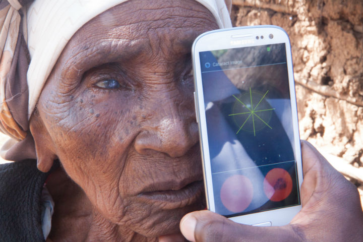 A Kenyan woman gets a cataract exam using Peek Vision's smartphone app.