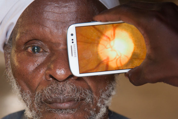 A man gets a retinal exam outside of his home in Kenya using a modified smartphone.