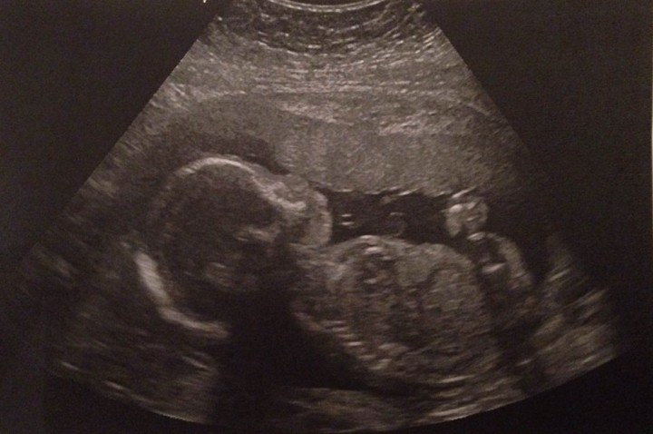 A provincial conference gets underway in Saskatoon to raise awareness about Fetal Alcohol Spectrum Disorder, otherwise known as FASD.