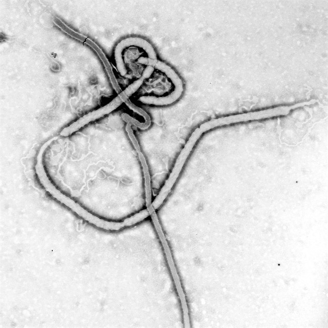 WHO reports man in isolation in Saskatoon hospital tests negative for Ebola virus, other haemorrhagic fevers.