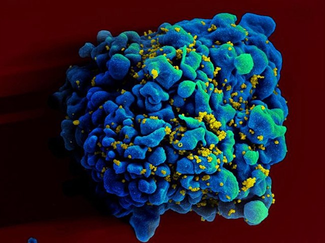 HIV-AIDS experts call for political action - image