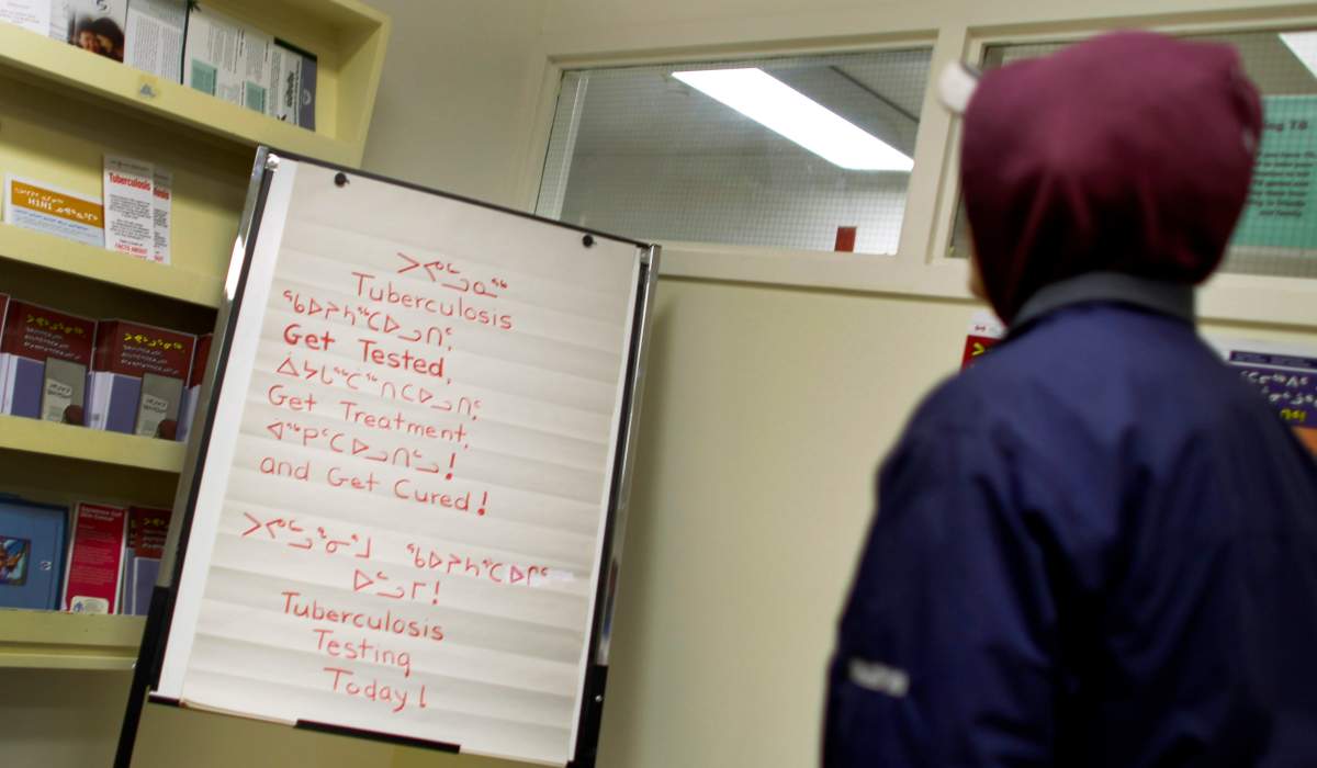 In Canada, tuberculosis is long gone – unless you’re aboriginal - image
