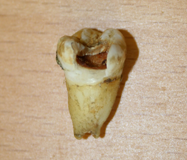 Alberta Dentist Who Purchased John Lennon s Tooth Hopes To Clone Him 