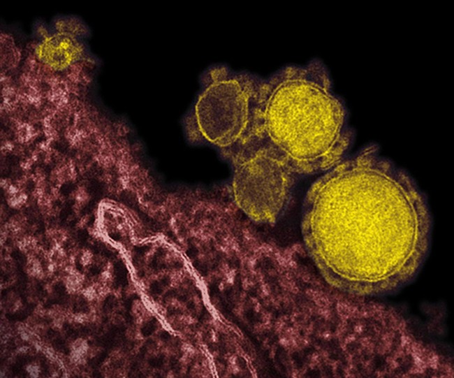 An undated electron microscope image shows novel coronavirus particles, also known as the MERS virus, colorized in yellow.