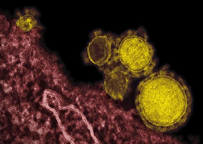 Novel coronavirus particles, also known as the MERS virus, colorized in yellow. 