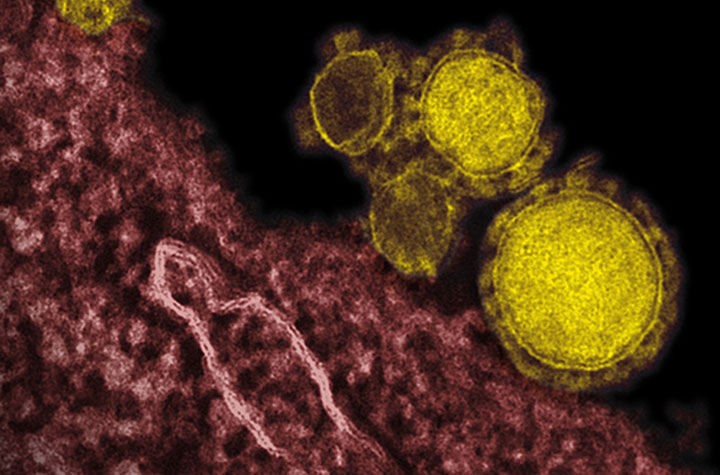North America has recorded its first case of local transmission of the MERS virus according to the CDC
