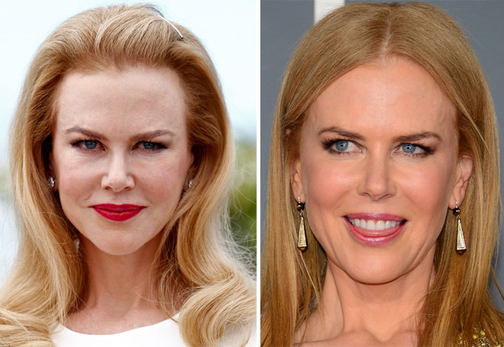 Cannes Appearance Has People Asking: What Happened To Nicole Kidman’s ...