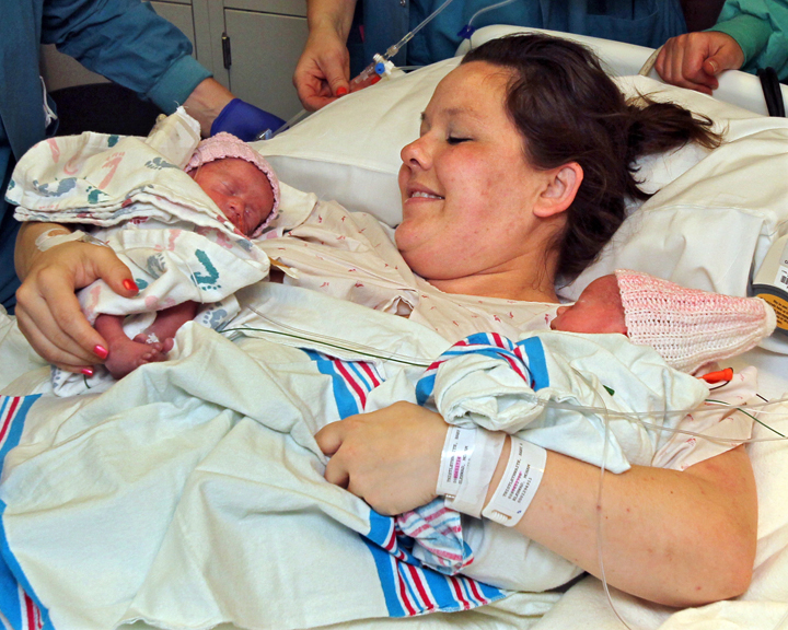 In this May 9, 2014 photo, Sarah Thistlethwaite holds her twin daughters, Jenna and Jillian, after her delivery of the monoamniotic twin girls at Akron General Hospital in Akron, Ohio.