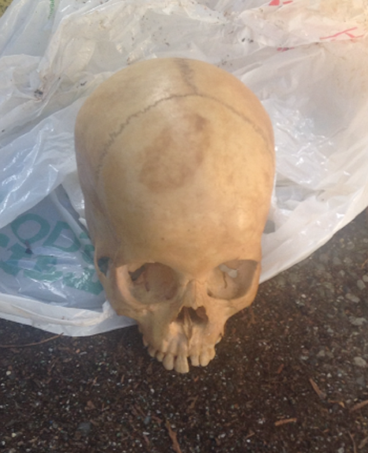 Police are investigating a human skull found in Victoria on May 15, 2014.