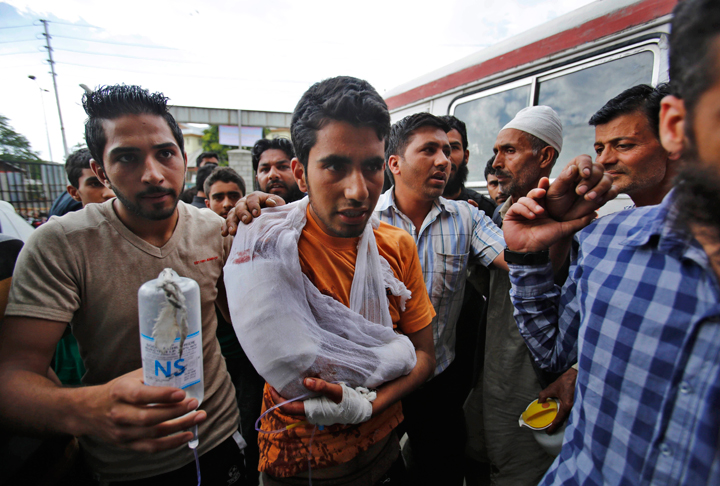 A Kashmiri youth, center, is brought for treatment at a hospital in Srinagar, India after he was injured in firing by Indian troops during a protest in Sopore, about 55 kilometers (34 miles) northwest of here, Monday, June 23, 2014. 