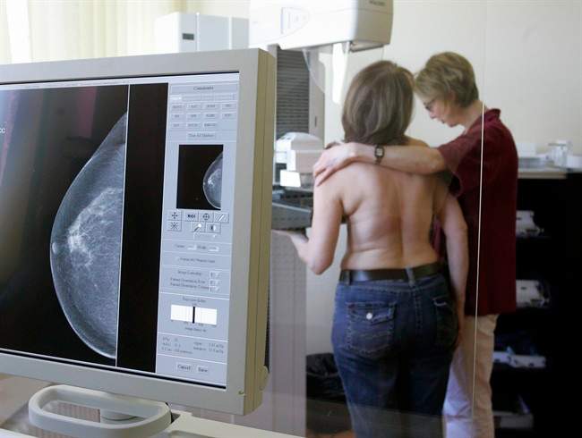 Mammogram