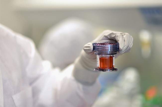 The possible alternatives to bone marrow transplant - image