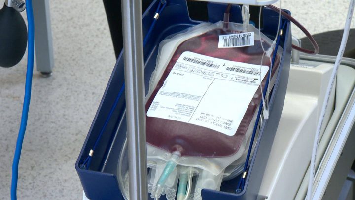Canadian Blood Services in Saskatoon is looking for 726 blood donors by the Labour Day long weekend.