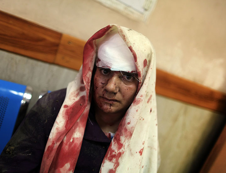 A Palestinian woman, who medics said was wounded by Israeli shelling, receives treatment at al-Shifa hospital in Gaza City.
