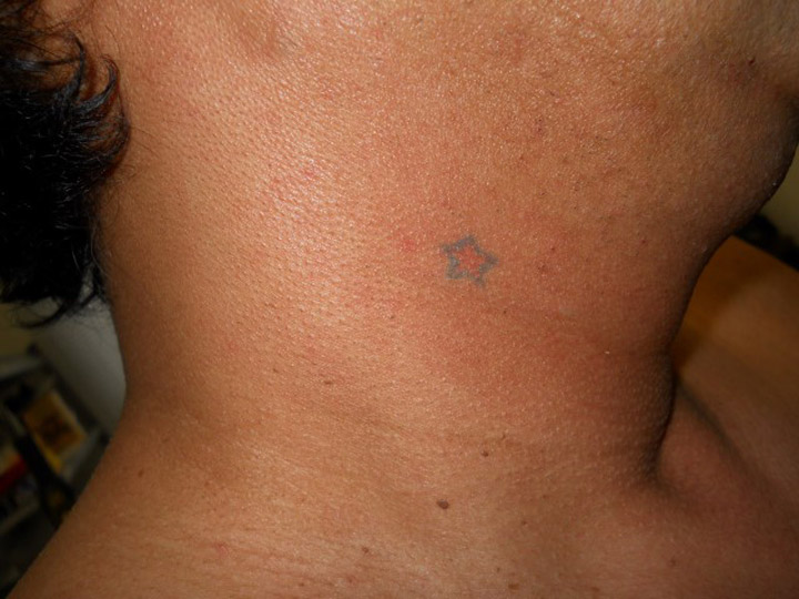 Saskatchewan RCMP have released this photo of a neck tattoo on Vincent Alex Desjarlais.