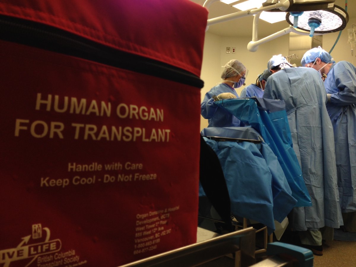 Six patients are getting kidney transplants from six donors at a San Francisco hospital.