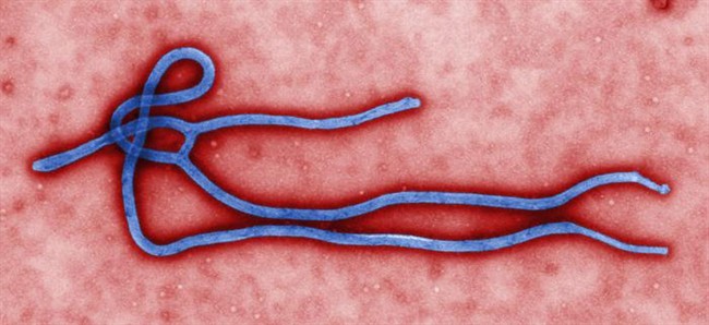 This undated file image made available by the CDC shows the Ebola Virus. Though similar, the Ebola-Reston virus that was found in the United States 25 years ago is not fatal to humans. 