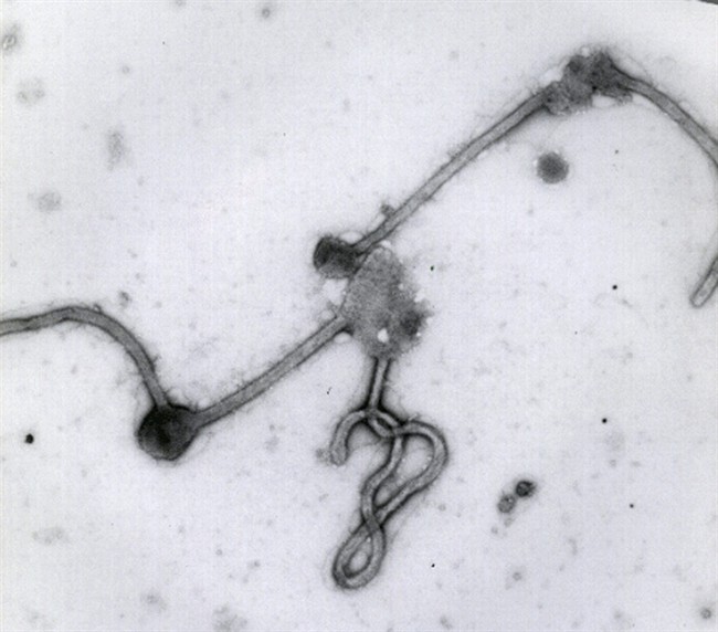 This undated photo made available by the Antwerp Institute of Tropical Medicine in Antwerp, Belgium, shows the Ebola virus viewed through an electron microscope.