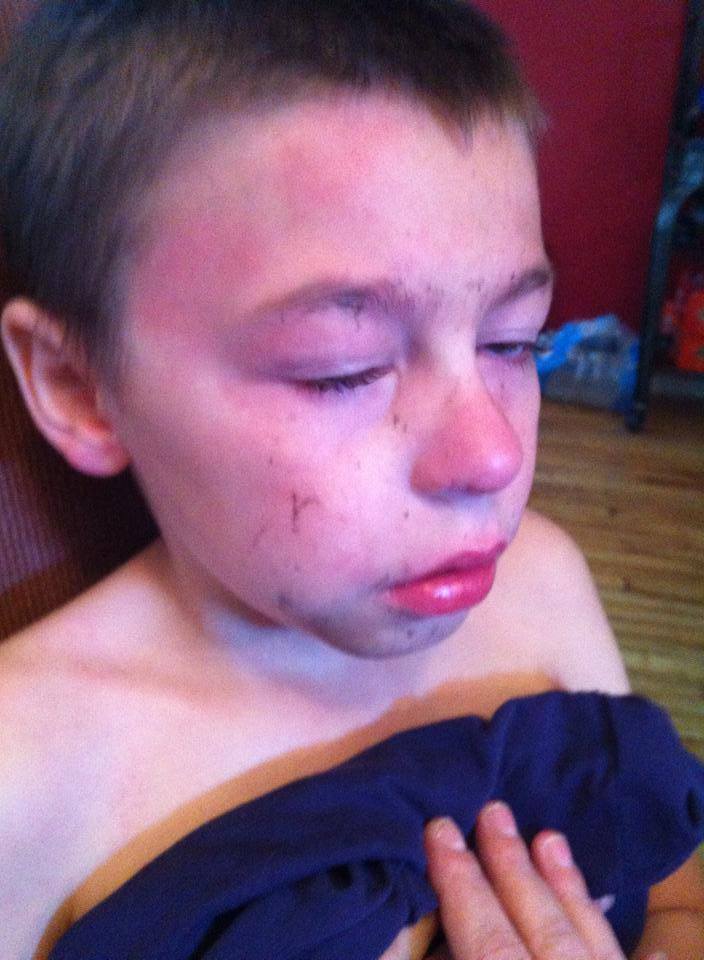 Zachary told his mother at least two teenagers hit him.