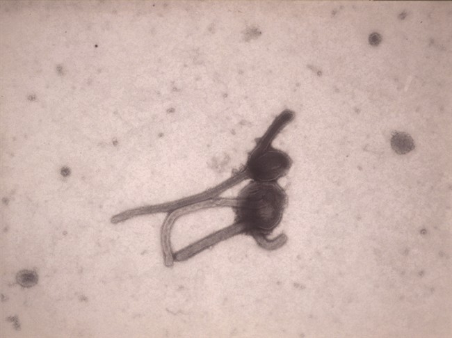 The Ebola virus viewed through an electron microscope.