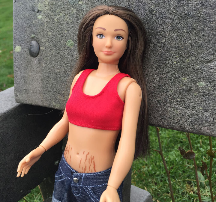 Lammily stretch marks