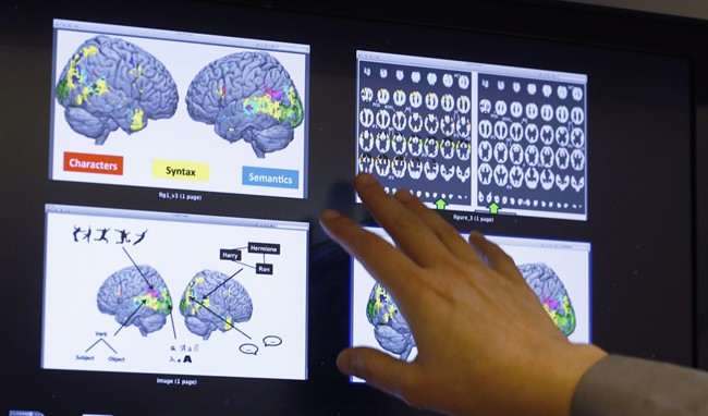 Leila Wehbe, a Ph.D. student at Carnegie Mellon University in Pittsburgh, displays images that used brain scans made from volunteers in a recent experiment while in her office on Wednesday Nov. 26, 2014. 