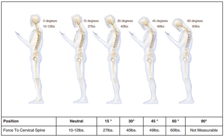 Sit up straight: Why your smartphone is wreaking havoc on your back - image