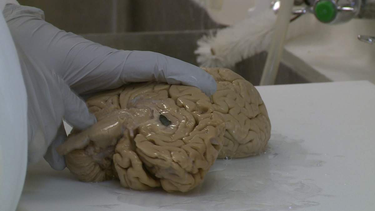 The Maritime Brain Tissue Bank was established approximately 20 years ago.