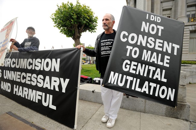 CDC: Circumcision benefits outweigh risks - image