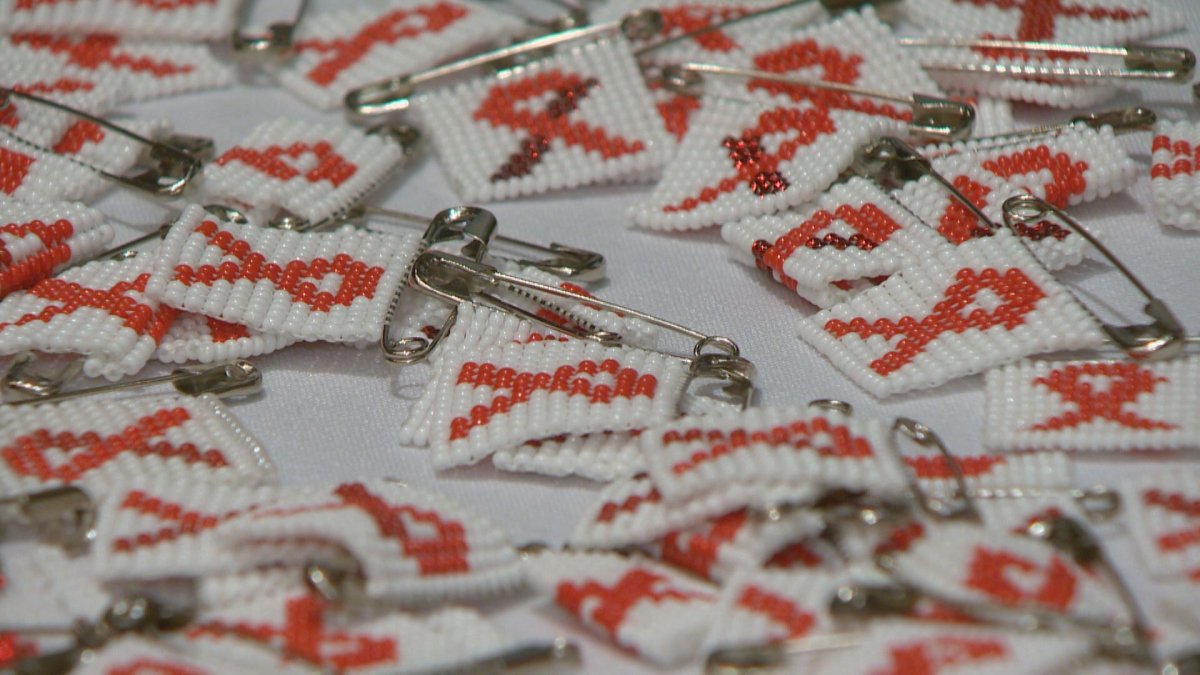 The rate of HIV and AIDS among Saskatchewan's Aboriginal population is among the highest in the world.