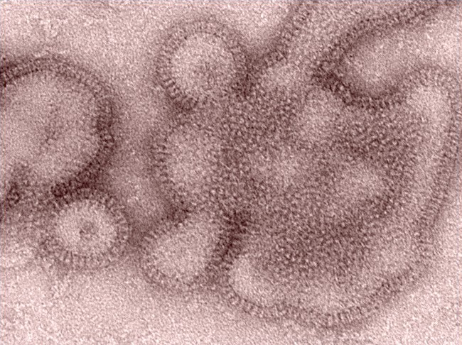 This 2011 image provided by the Centers for Disease Control and Prevention shows an H3N2 influenza virus.


