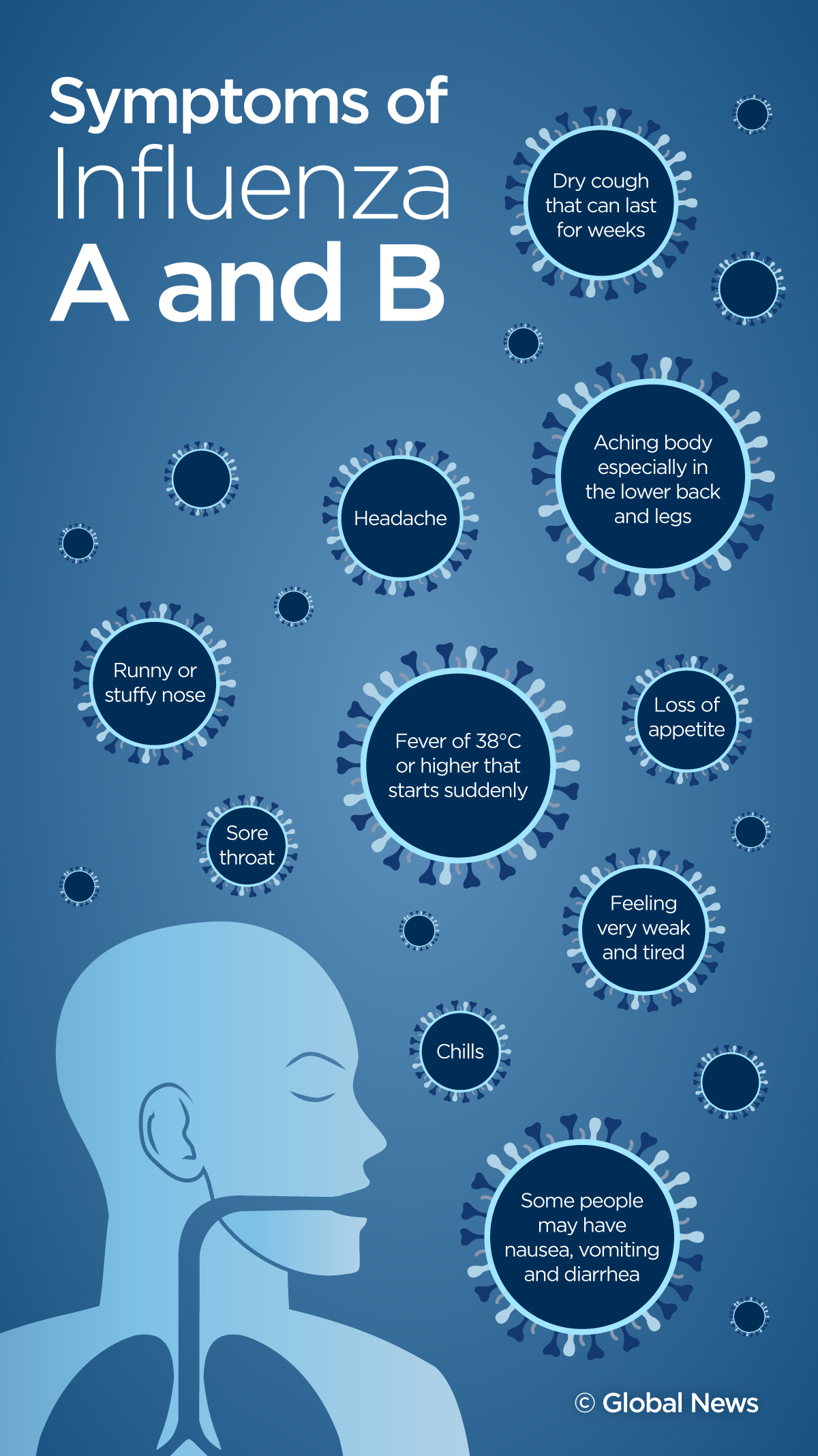 Flu And Norovirus, Among Illnesses Making The Rounds In Calgary ...