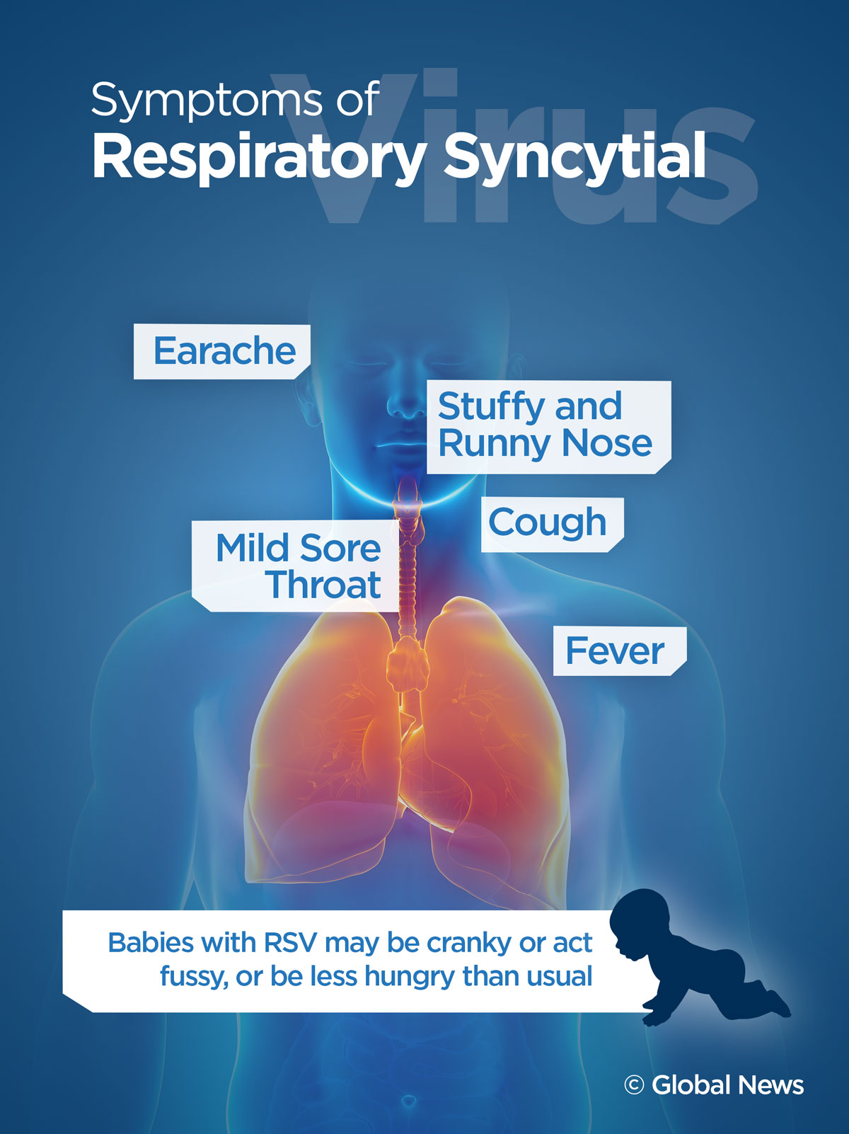 Common symptoms of the Respiratory Syntical Virus which has been connected to sixth deaths at a care home in Halifax.