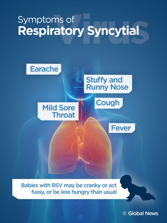 Flu and Norovirus, among illnesses making the rounds in Calgary ...