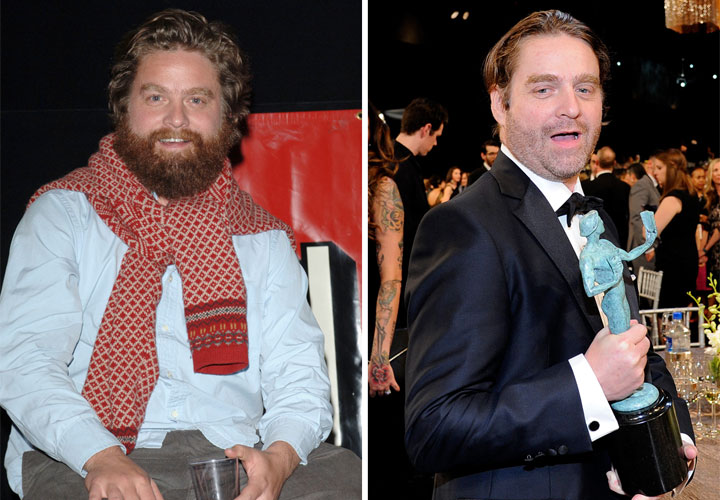 Zach Galifianakis, pictured in 2005 (left) and on Jan. 25, 2015.