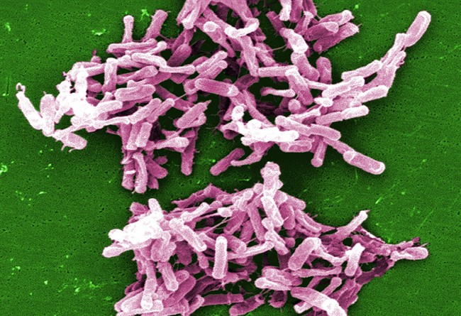This 2004 electron microscope image made available by the Centers for Disease Control and Prevention shows a cluster of Clostridium difficile bacteria. 